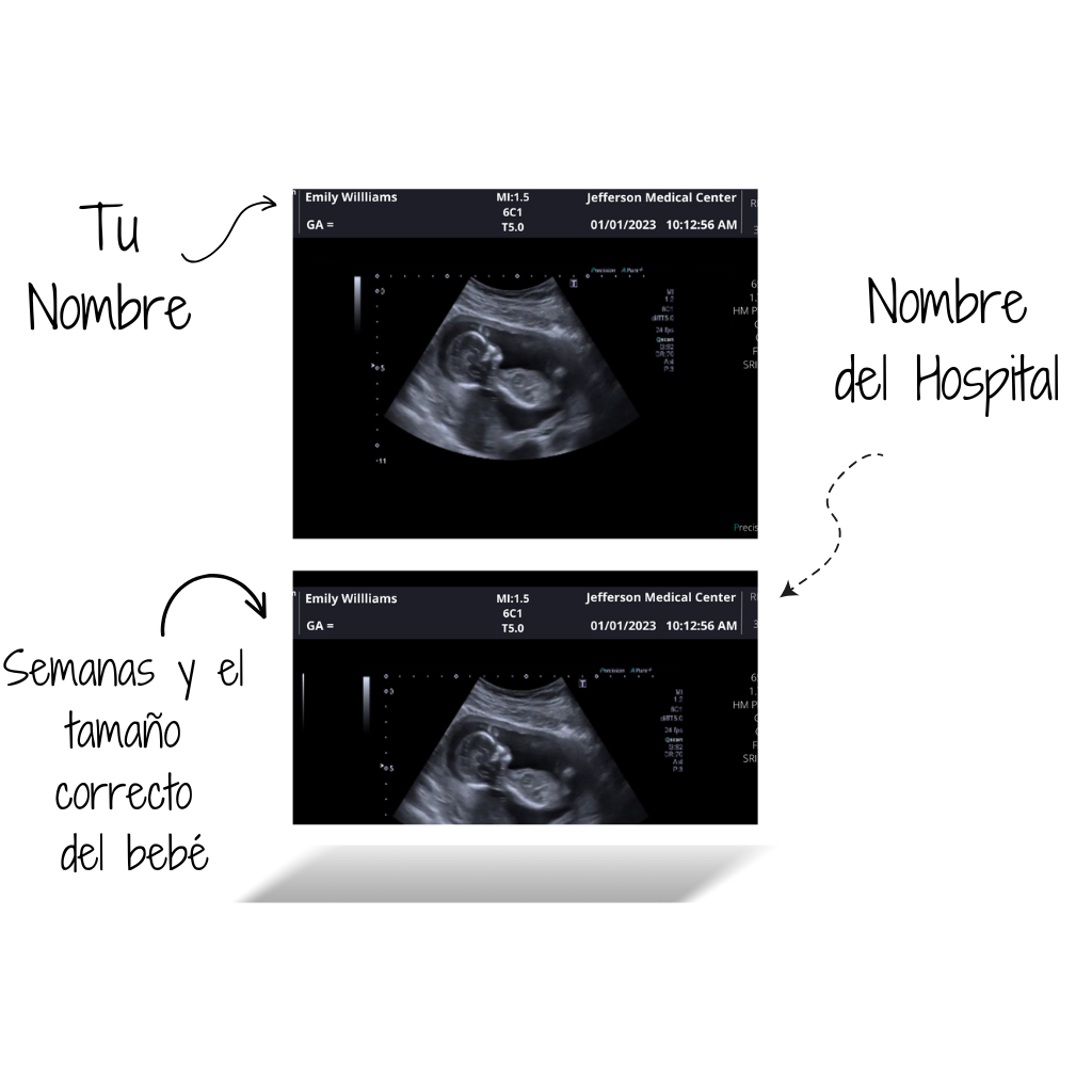 Imagen de ultrasonido